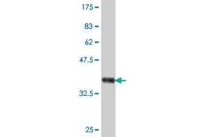 Western Blot detection against Immunogen (37 KDa) . (Ribophorin II 抗体  (AA 141-239))