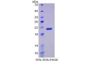 SDS-PAGE analysis of Mouse MMP12 Protein. (MMP12 蛋白)