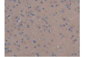 IHC-P analysis of Mouse Liver Tissue, with DAB staining. (MAP6 抗体  (AA 177-387))