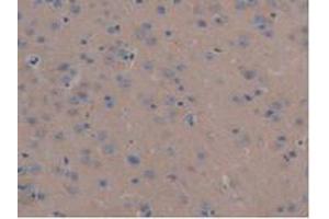 IHC-P analysis of Mouse Liver Tissue, with DAB staining. (MAP6 抗体  (AA 177-387))
