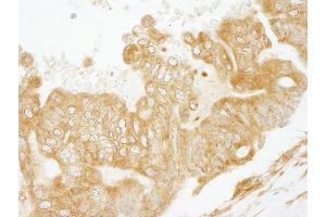 Immunohistochemistry (IHC) image for anti-Early Endosome Antigen 1 (EEA1) (AA 100-150) antibody (ABIN7448541)