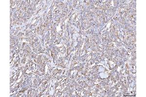 IHC analysis of PLP2 using anti-PLP2 antibody (ABIN7600320). (PLP2 抗体  (AA 18-152))