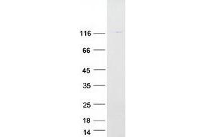Western Blotting (WB) image for ATPase, H+ Transporting, Lysosomal V0 Subunit A1 (ATP6V0A1) (Transcript Variant 3) protein (Myc-DYKDDDDK Tag) (ABIN2715049)