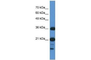 C1orf144 antibody used at 1 ug/ml to detect target protein. (C1orf144 抗体  (N-Term))