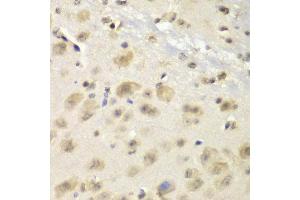 Immunohistochemistry of paraffin-embedded mouse brain using S100A10 antibody at dilution of 1:100 (x40 lens). (S100A10 抗体)