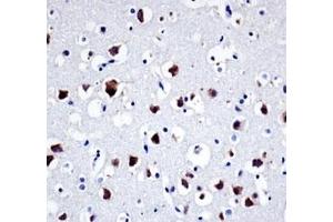 Immunohistochemistry (IHC) image for anti-Proto-oncogene tyrosine-protein kinase Src (Src) (AA 24-52) antibody (ABIN3029554)