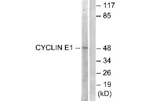 Western blot analysis of extracts from HeLa cells, treated with Paclitasel (1uM, 60mins), using Cyclin(Ab-395) antibody (#B0069, Line 1 and 2). (Cyclin E1 抗体  (Thr395))