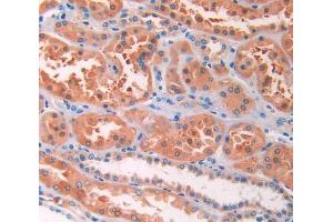 IHC-P analysis of kidney tissue, with DAB staining. (IL13 Receptor alpha 1 抗体  (AA 203-376))