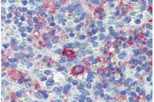 Spleen, Human: Formalin-Fixed, Paraffin-Embedded (FFPE) (CD163 抗体)