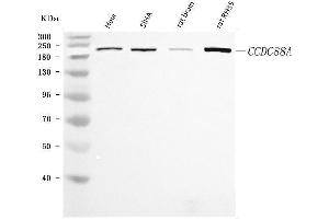 Western blot analysis of CCDC88A using anti-CCDC88A antibody (ABIN7599868).