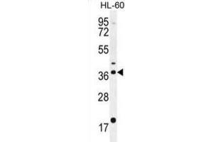 Western Blotting (WB) image for anti-Olfactory Receptor, Family 2, Subfamily W, Member 1-Like (OR2W3) antibody (ABIN2996112) (OR2W3 抗体)