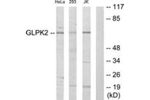 Western blot analysis of extracts from HeLa/293/Jurkat cells, using GK2 Antibody. (GK2 抗体  (AA 281-330))