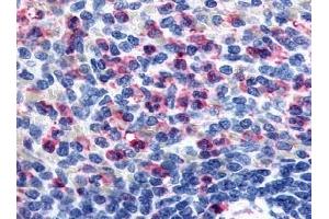 Immunohistochemical staining of spleen neutrophils using anti-GPR43 antibody ABIN122154 (FFAR2 抗体)