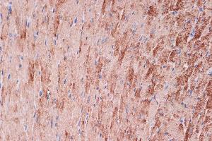 Immunohistochemistry (IHC) image for anti-Tropomyosin 1 (Alpha) (TPM1) antibody (ABIN7271013)