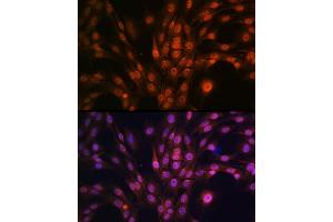 Immunofluorescence analysis of C6 cells using P antibody (ABIN7269146) at dilution of 1:100.