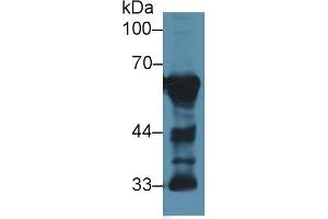 Detection of CaN in Rat Cerebrum lysate using Polyclonal Antibody to Calcineurin (CaN) (CAN 抗体  (AA 7-301))