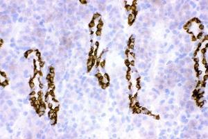 IHC analysis of HSD11B2 using anti-HSD11B2 antibody (ABIN3043846).