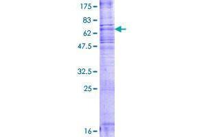 Sphingomyelin Synthase 2 Protein (SGMS2) (AA 1-365) (GST tag)