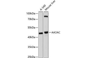 Western blot analysis of extracts of various cell lines, using AADAC antibody (ABIN6129181, ABIN6136310, ABIN6136312 and ABIN6214595) at 1:1000 dilution. (AADAC 抗体  (AA 170-399))