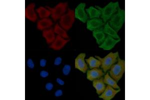 ABIN6257012 and ABIN6274964 staining Hela cells(45 min of heat-shock) by IF/ICC.