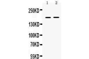 Western blot analysis of Ceruloplasmin expression in rat skeletal muscle extract (lane 1), and NIH3T3 whole cell lysates (lane 2).