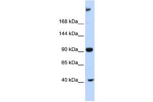 WB Suggested Anti-MPDZ Antibody Titration:  0. (MPDZ 抗体  (Middle Region))