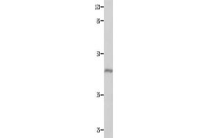 Gel: 10 % SDS-PAGE, Lysate: 40 μg, Lane: Mouse eyes tissue, Primary antibody: ABIN7129618(GNA11 Antibody) at dilution 1/550, Secondary antibody: Goat anti rabbit IgG at 1/8000 dilution, Exposure time: 10 seconds (GNA11 抗体)