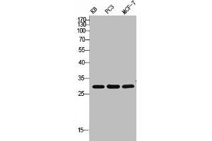 Western Blot analysis of KB PC-3 MCF7 cells using ApoF Polyclonal Antibody (Apolipoprotein F 抗体  (C-Term))