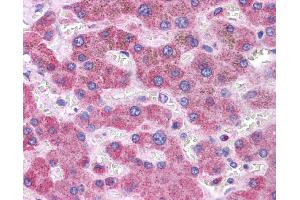 Immunohistochemistry (IHC) image for anti-Glutathione S-Transferase mu 1 (GSTM1) (C-Term) antibody (ABIN2776985) (GSTM1 抗体  (C-Term))
