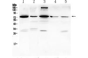 Western blot analysis of PTGS2 using anti- PTGS2 antibody . (PTGS2 抗体  (Middle Region))