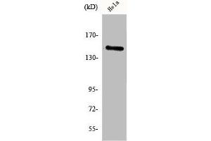 Western Blot analysis of HeLa cells using JIP-3 Polyclonal Antibody (JIP3 抗体  (Internal Region))