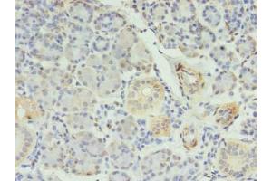 Immunohistochemistry of paraffin-embedded human pancreatic tissue using ABIN7150385 at dilution of 1:100 (RFX6 抗体  (AA 1-260))