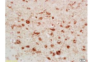 Formalin-fixed and paraffin embedded rat brain labeled with Anti-Calretinin/CA Polyclonal Antibody, Unconjugated (ABIN724355) followed by conjugation to the secondary antibody and DAB staining (Calretinin 抗体  (AA 211-271))
