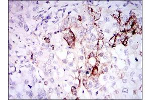 Immunohistochemistry (IHC) image for anti-Somatostatin (SST) (AA 1-116) antibody (ABIN1098123)