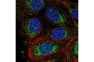 Immunofluorescent staining of MCF7 cells with NDUFS3 polyclonal antibody  (Green) shows positivity in nucleus and mitochondria. (NDUFS3 抗体)