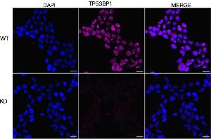 Immunocytochemical staining of HeLa cells using TP53BP1 antibody (ABIN7800690), 1:1,000), Top panel: wild-type (WT), Bottom panal: TP53BP1 shRNA knockdown (KD). (TP53BP1 抗体)