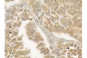 ABIN6257879 and ABIN6275537 at 1/100 staining human normal kidney tissue by IHC-P.