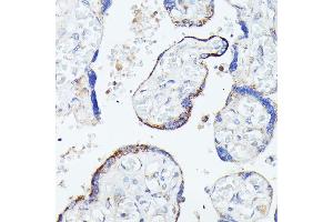 Immunohistochemistry of paraffin-embedded human placenta using HSPB11 antibody (ABIN7267591) at dilution of 1:100 (40x lens). (HSPB11 抗体)