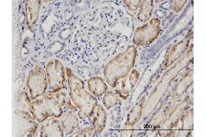 Immunoperoxidase of monoclonal antibody to SLC22A6 on formalin-fixed paraffin-embedded human kidney. (SLC22A6 抗体  (AA 451-550))