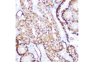 Immunohistochemistry of paraffin-embedded mouse kidney using NDRG1 Rabbit mAb (ABIN7268783) at dilution of 1:100 (40x lens). (NDRG1 抗体)