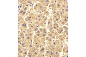 Immunohistochemical analysis of paraffin-embedded H. (UBE2D1 抗体  (C-Term))