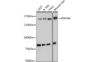 Western blot analysis of extracts of various cell lines, using PRPF4B antibody (ABIN7270232) at 1:1000 dilution. (PRPF4B 抗体  (AA 550-760))