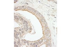 anti-ATP-Binding Cassette, Sub-Family F (GCN20), Member 2 (ABCF2) (AA 573-623) antibody