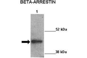 Sample Type :  Lane 1: 20ug mouse left ventricle heart lysate  Primary Antibody Dilution :   1:1000  Secondary Antibody:  Anti-rabbit-HRP  Secondary Antibody Dilution:   1:5000  Color/Signal Descriptions:  ARRB2  Gene Name:  Kathleen Gabrielson  Submitted by: (Arrestin 3 抗体  (Middle Region))