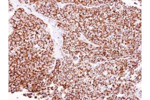 Immunohistochemistry (IHC) image for anti-Aldehyde Dehydrogenase 2 Family (Mitochondrial) (ALDH2) (Center) antibody (ABIN2855041)