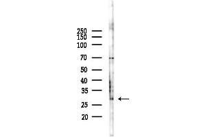 anti-VAMP (Vesicle-Associated Membrane Protein)-Associated Protein B and C (VAPB) (C-Term) antibody