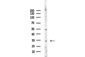 anti-SERTA Domain Containing 2 (SERTAD2) antibody