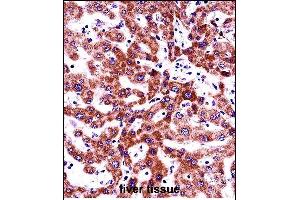ITGB5 Antibody (N-term) (ABIN657921 and ABIN2846868) immunohistochemistry analysis in formalin fixed and paraffin embedded human liver tissue followed by peroxidase conjugation of the secondary antibody and DAB staining. (Integrin beta 5 抗体  (N-Term))