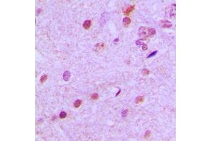 Immunohistochemical analysis of NEUROD2 staining in human brain formalin fixed paraffin embedded tissue section. (NEUROD2 抗体  (Center))