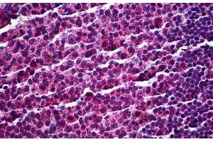 Human Tonsil: Formalin-Fixed, Paraffin-Embedded (FFPE) (SP140 抗体  (AA 504-613))